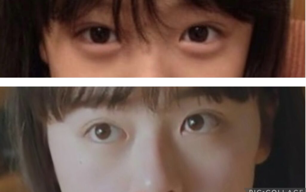 上坂樹里さんの整形疑惑の目の比較画像